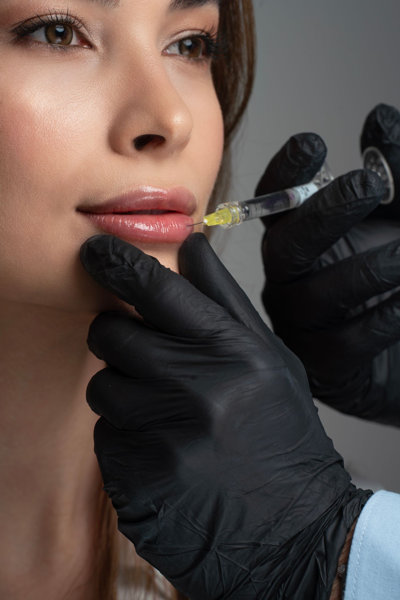 Lipfiller behandeling