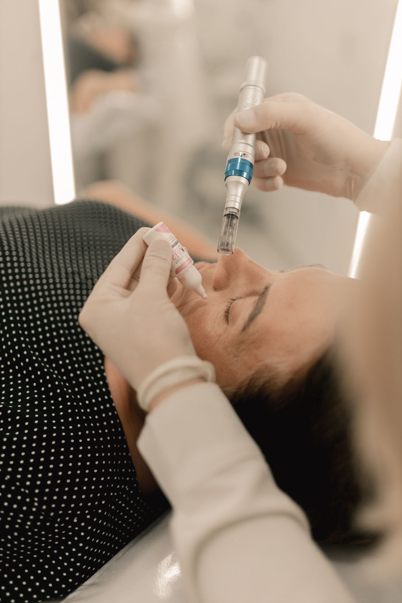 Microneedling behandeling